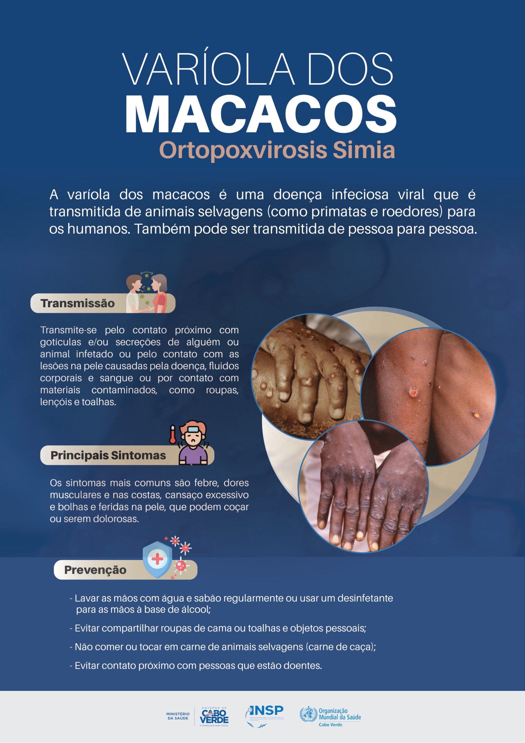 Cartaz Variola dos Macacos-1